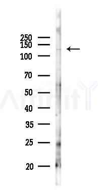 RC3H1 Antibody - Western blot analysis of lysates from B16F10-LUC cells(heat-shock 45min treatment), using RC3H1 Antibody at 1/1000 dilution.