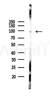 TGS1 Antibody - Western blot analysis of lysates from Mouse lung, using TGS1 Antibody at 1/1000 dilution.