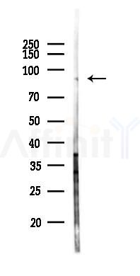 EVI5 Antibody - Western blot analysis of lysates from Hela cells(heat-shock 45min treatment), using EVI5 Antibody at 1/1000 dilution.