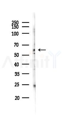 DDX28 Antibody - Western blot analysis of lysates from Hela cells(heat-shock 45min treatment), using DDX28 Antibody at 1/1000 dilution.