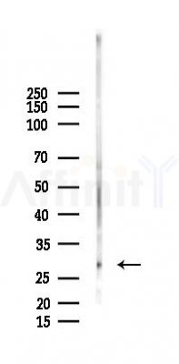 KLK15 Antibody - Western blot analysis of lysates from Rat lung, using KLK15 Antibody at 1/1000 dilution.