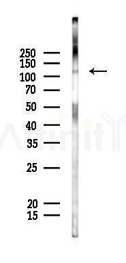 PPP6R2 Antibody - Western blot analysis of lysates from K562 cells(starvation 24h treatment), using PPP6R2 Antibody at 1/1000 dilution.