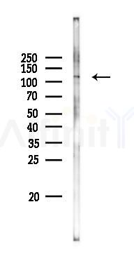 PPP6R2 Antibody - Western blot analysis of lysates from PC12 cells(LPS 4h treatment), using PPP6R2 Antibody at 1/1000 dilution.
