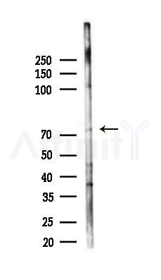 FNBP1 Antibody - Western blot analysis of lysates from 293 cells(heat-shock 45min treatment), using FNBP1 Antibody at 1/1000 dilution.