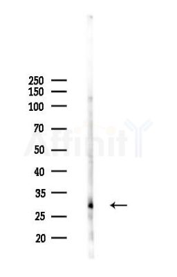 CRISP1 Antibody - Western blot analysis of lysates from HUVEC cells(LPS 4h treatment), using CRISP1 Antibody at 1/1000 dilution.