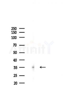 TIPIN Antibody - Western blot analysis of lysates from A2780 cells(starvation 24h treatment), using TIPIN Antibody at 1/1000 dilution.