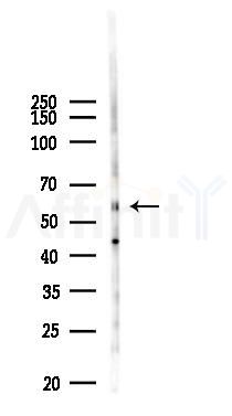 SLC45A2 Antibody - Western blot analysis of lysates from B16F10-LUC cells(heat-shock 45min treatment), using SLC45A2 Antibody at 1/1000 dilution.