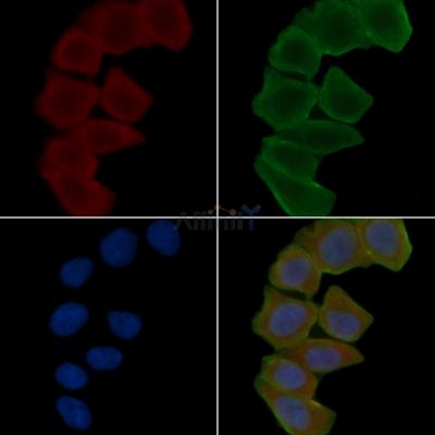 KCNJ1 Antibody - DF15757 staining Hela cells(30min of UV treatment) by IF/ICC.