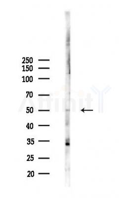 PELI3 Antibody - Western blot analysis of lysates from A2780 cells(starvation 24h treatment), using PELI3 Antibody at 1/1000 dilution.