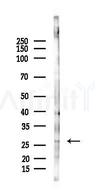 MARCH2 Antibody - Western blot analysis of lysates from Mouse liver, using MARCH2 Antibody at 1/1000 dilution.