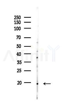 PROK2 Antibody - Western blot analysis of lysates from EC304 cells(starvation 24h treatment), using PROK2 Antibody at 1/1000 dilution.