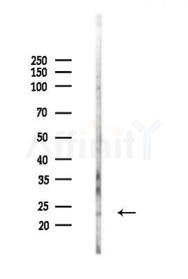 NMRK2 Antibody - Western blot analysis of lysates from Rat testis, using NMRK2 Antibody at 1/1000 dilution.