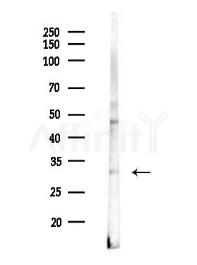 MARCH5 Antibody - Western blot analysis of lysates from HUVEC cells(LPS 4h treatment), using MARCH5 Antibody at 1/1000 dilution.