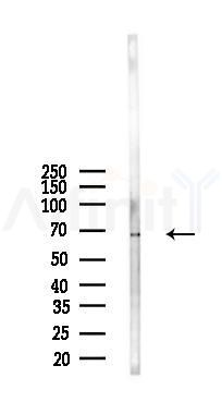 JPH4 Antibody - Western blot analysis of lysates from B16F10-LUC cells(heat-shock 45min treatment), using JPH4 Antibody at 1/1000 dilution.