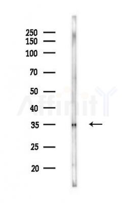 AKAP7 Antibody - Western blot analysis of lysates from HUVEC cells(LPS 4h treatment), using AKAP7 Antibody at 1/1000 dilution.