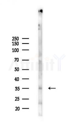 AKAP7 Antibody - Western blot analysis of lysates from A2780 cells(starvation 24h treatment), using AKAP7 Antibody at 1/1000 dilution.