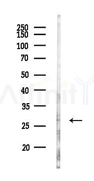 JAZF1 Antibody - Western blot analysis of lysates from K562 cells(UV 30min treatment), using JAZF1 Antibody at 1/1000 dilution.