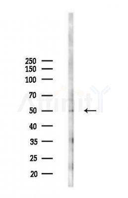 SLC41A3 Antibody - Western blot analysis of lysates from A2780 cells(starvation 24h treatment), using SLC41A3 Antibody at 1/1000 dilution.