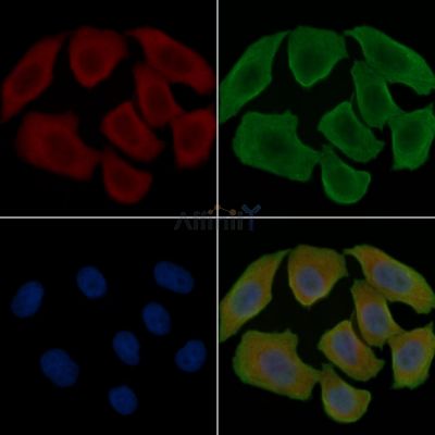 SLC25A28 Antibody - DF15800 staining Hela cells(30min of UV treatment) by IF/ICC.