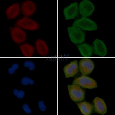 SMG8 Antibody - DF15802 staining Hela cells(30min of UV treatment) by IF/ICC.