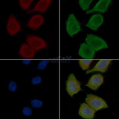 QPCTL Antibody - DF15810 staining Hela cells(30min of UV treatment) by IF/ICC.