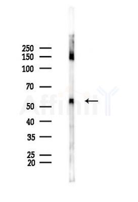 ALG6 Antibody - Western blot analysis of lysates from Mouse liver, using ALG6 Antibody at 1/1000 dilution.