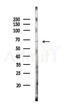PIGT Antibody - Western blot analysis of lysates from EC304 cells(starvation 24h treatment), using PIGT Antibody at 1/1000 dilution.
