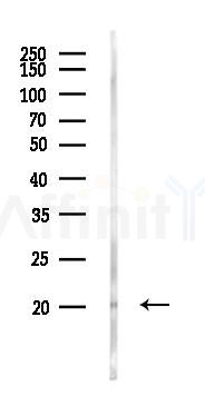 ASCL4 Antibody - Western blot analysis of lysates from K562 cells(UV 30min treatment), using ASCL4 Antibody at 1/1000 dilution.