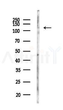 PLEKHH2 Antibody - Western blot analysis of lysates from K562 cells(UV 30min treatment), using PLEKHH2 Antibody at 1/1000 dilution.