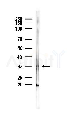 TSPAN10 Antibody - Western blot analysis of lysates from K562 cells(heat-shock 45min treatment), using TSPAN10 Antibody at 1/1000 dilution.