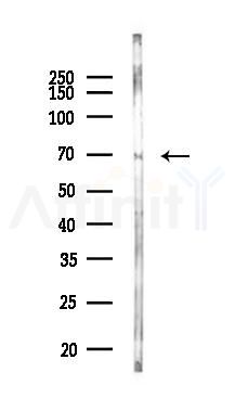 LILRB3 Antibody - Western blot analysis of lysates from Rat lung, using LILRB3 Antibody at 1/1000 dilution.