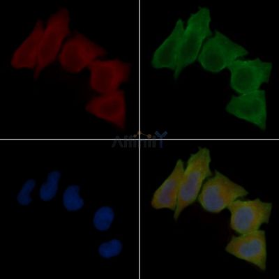 SLC35F6 Antibody - DF15845 staining Hela cells(30min of UV treatment) by IF/ICC.