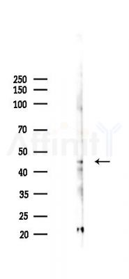 QTRT2 Antibody - Western blot analysis of lysates from EC304 cells(starvation 24h treatment), using QTRT2 Antibody at 1/1000 dilution.