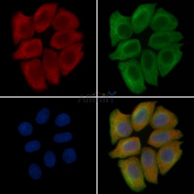 QTRT2 Antibody - DF15847 staining Hela cells(45min of heat-shock treatment) by IF/ICC.