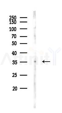 CLN8 Antibody - Western blot analysis of lysates from Rat lung, using CLN8 Antibody at 1/1000 dilution.
