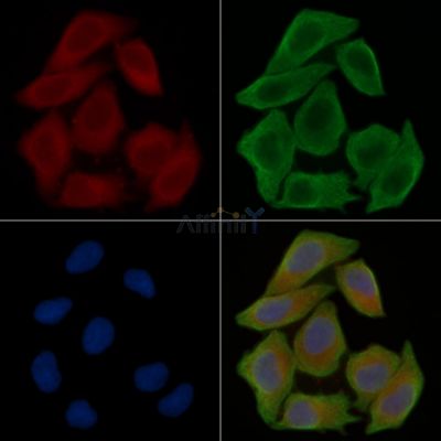 ABI3BP Antibody - DF15851 staining Hela cells(30min of UV treatment) by IF/ICC.