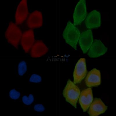 NAXD Antibody - DF15854 staining Hela cells(30min of UV treatment) by IF/ICC.