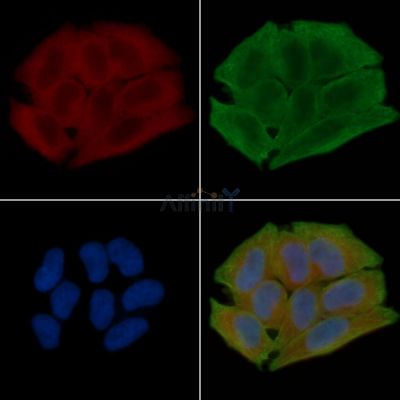 HACD4 Antibody - DF15858 staining Hela cells(30min of UV treatment) by IF/ICC.