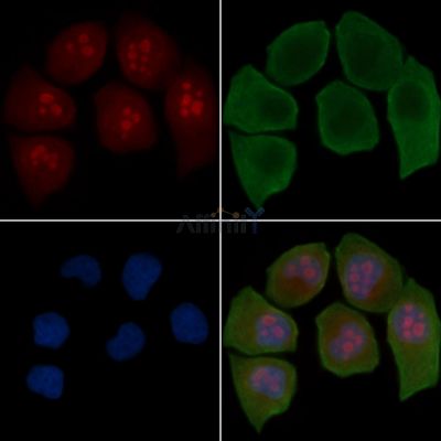 TSR1 Antibody - DF15859 staining Hela cells(30min of UV treatment) by IF/ICC.
