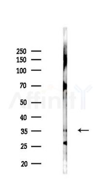 KLHDC8A Antibody - Western blot analysis of lysates from PC12 cells(LPS 4h treatment), using KLHDC8A Antibody at 1/1000 dilution.