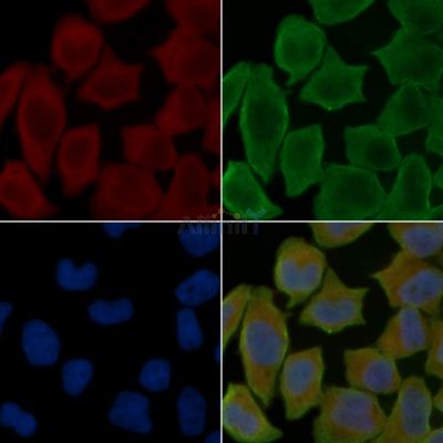 KIAA0930 Antibody - DF15866 staining Hela cells(30min of UV treatment) by IF/ICC.