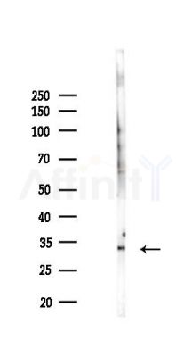SCML1 Antibody - Western blot analysis of lysates from PC12 cells(LPS 4h treatment), using SCML1 Antibody at 1/1000 dilution.