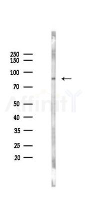 VWF Antibody - Western blot analysis of lysates from Hela cells(heat-shock 45min treatment), using VWF Antibody at 1/1000 dilution.