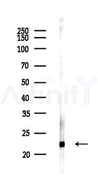 RBPMS2 Antibody - Western blot analysis of lysates from K562 cells(UV 30min treatment), using RBPMS2 Antibody at 1/1000 dilution.