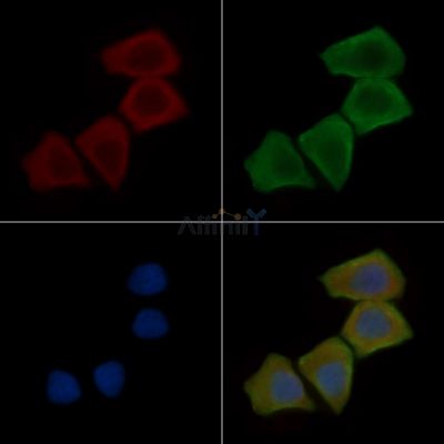 NIPA2 Antibody - DF15888 staining Hela cells(30min of UV treatment) by IF/ICC.