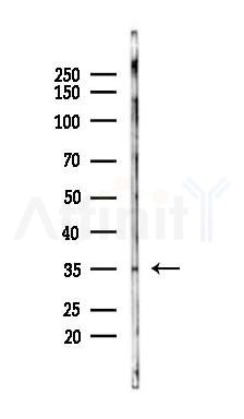 LTB4R2 Antibody - Western blot analysis of lysates from Rat testis, using LTB4R2 Antibody at 1/1000 dilution.
