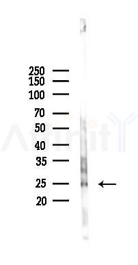 PRRG1 Antibody - Western blot analysis of lysates from Mouse lung, using PRRG1 Antibody at 1/1000 dilution.