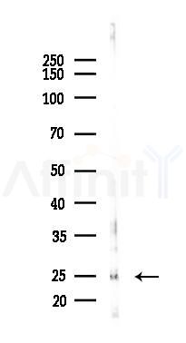 PRRG1 Antibody - Western blot analysis of lysates from Hela cells(starvation 24h treatment), using PRRG1 Antibody at 1/1000 dilution.