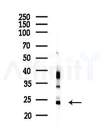 C7orf61 Antibody - Western blot analysis of lysates from Hela cells(starvation 24h treatment), using C7orf61 Antibody at 1/1000 dilution.
