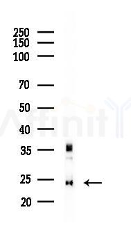 C7orf61 Antibody - Western blot analysis of lysates from HUVEC cells(starvation 24h treatment), using C7orf61 Antibody at 1/1000 dilution.